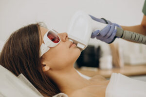 Laser Hair Removal Revolution